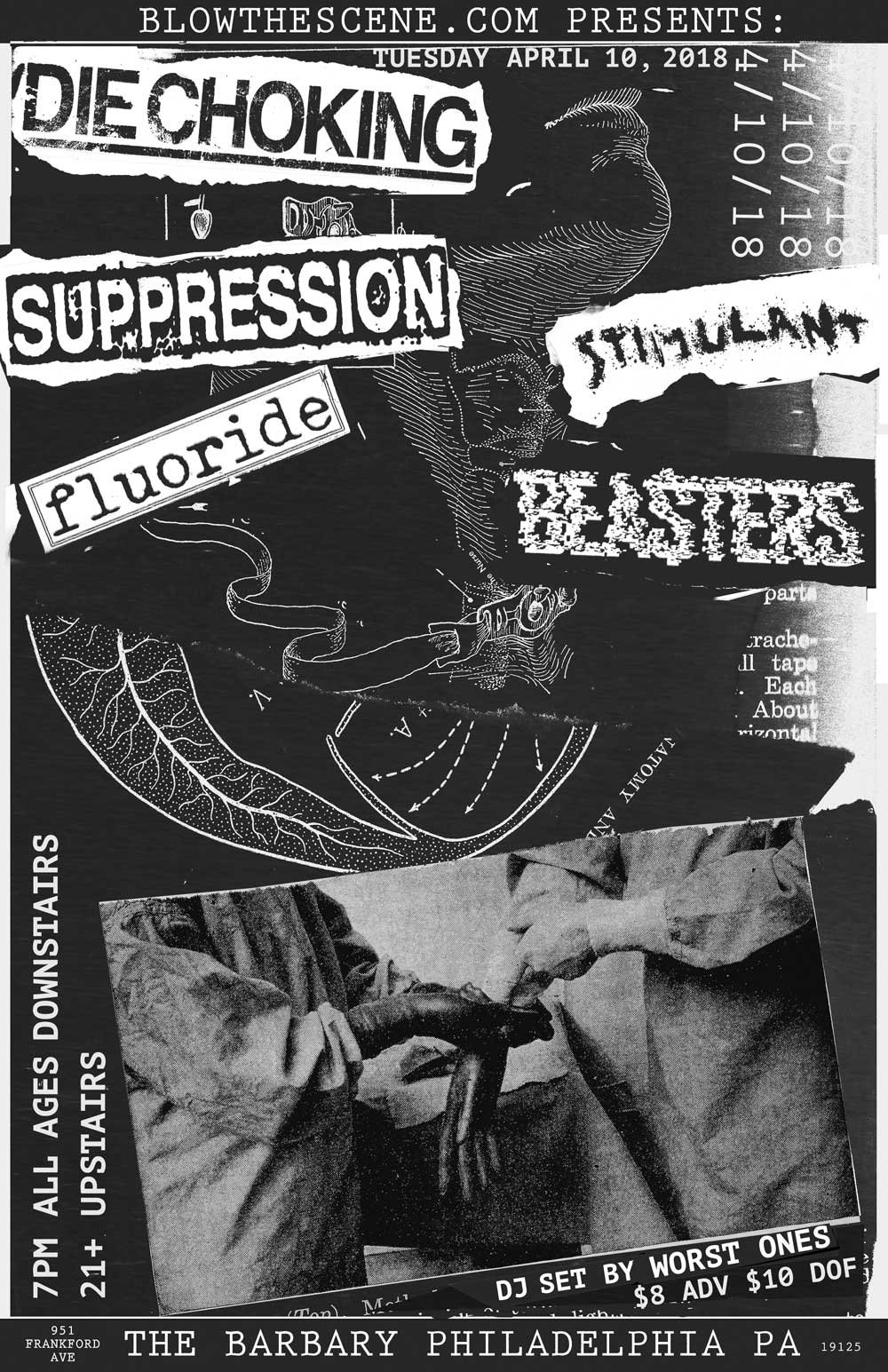 die choking suppression philly 2018